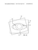 REAL-TIME SURGICAL REFERENCE INDICIUM APPARATUS AND METHODS FOR     INTRAOCULAR LENS IMPLANTATION diagram and image