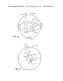 REAL-TIME SURGICAL REFERENCE INDICIUM APPARATUS AND METHODS FOR     INTRAOCULAR LENS IMPLANTATION diagram and image