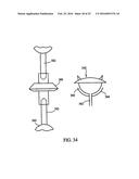 Expandable Vertebral Prosthesis diagram and image