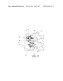 MINIMALLY INVASIVE SPINAL FUSION SYSTEM AND METHOD diagram and image