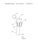 Femoral Implant Revision Tool diagram and image