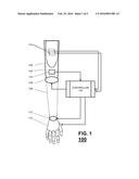 COORDINATED CONTROL FOR AN ARM PROSTHESIS diagram and image