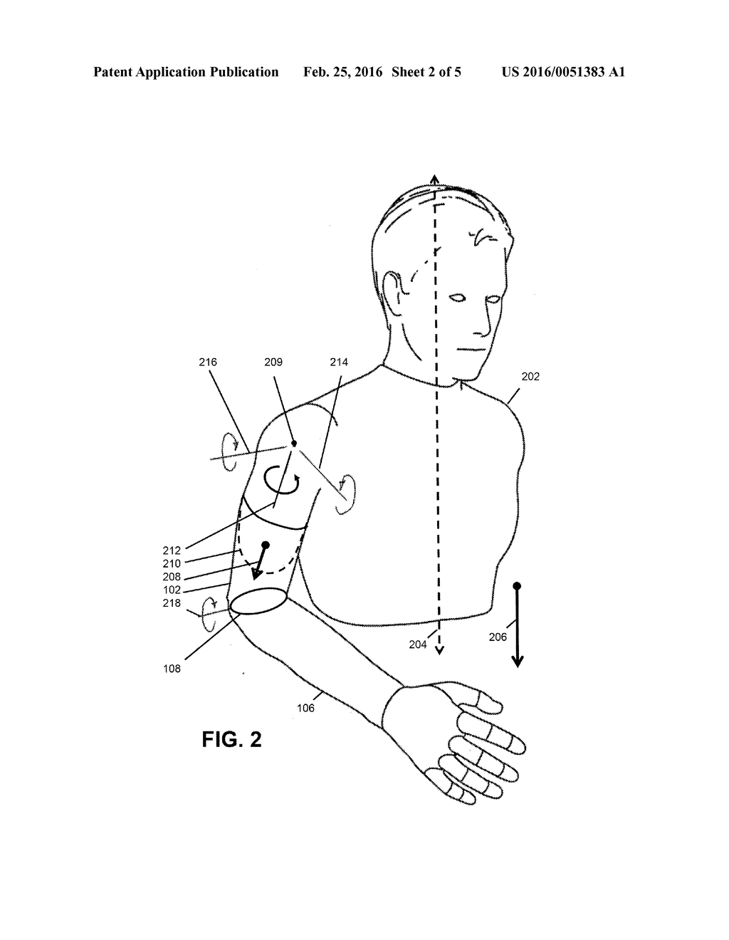 COORDINATED CONTROL FOR AN ARM PROSTHESIS - diagram, schematic, and image 03