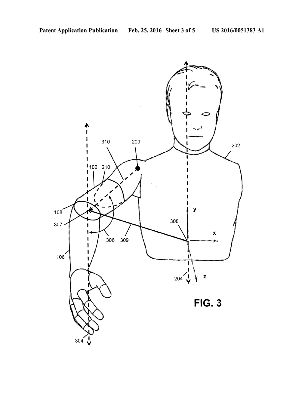 COORDINATED CONTROL FOR AN ARM PROSTHESIS - diagram, schematic, and image 04