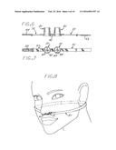 SLEEP APNEA DEVICE TO POSITIVELY BLOCK EXHALING AND METHOD OF USE diagram and image