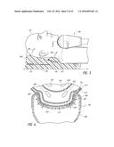 TREATMENT SYSTEMS, SMALL VOLUME APPLICATORS, AND METHODS FOR TREATING     SUBMENTAL TISSUE diagram and image