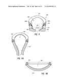 TREATMENT SYSTEMS, SMALL VOLUME APPLICATORS, AND METHODS FOR TREATING     SUBMENTAL TISSUE diagram and image