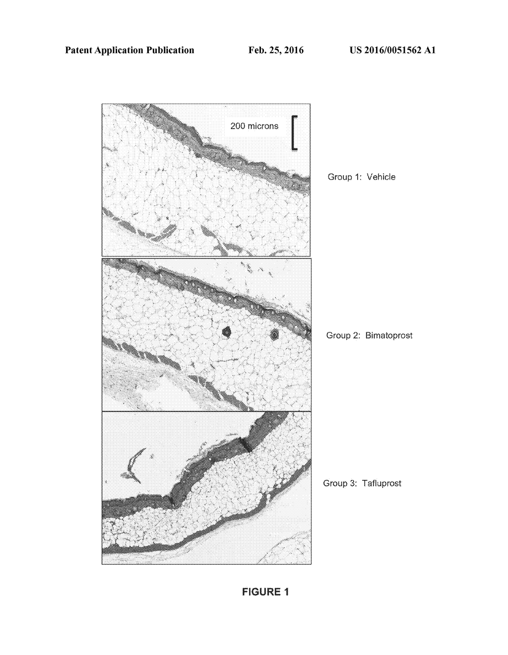 METHODS AND COMPOSITIONS FOR REDUCING BODY FAT AND ADIPOCYTES - diagram, schematic, and image 02