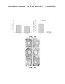 COMPOSITIONS AND METHODS FOR TREATMENT OF VESSEL DISEASE diagram and image