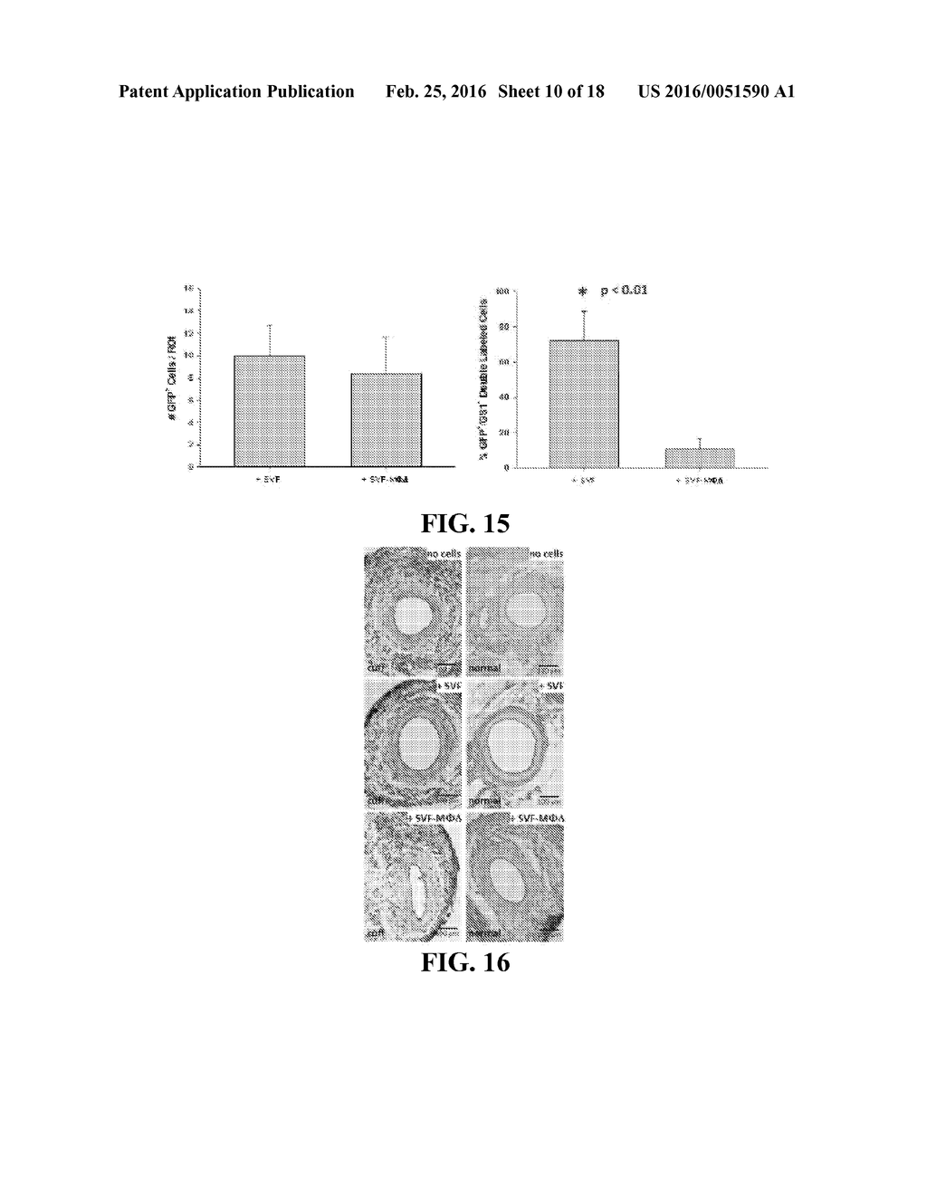 COMPOSITIONS AND METHODS FOR TREATMENT OF VESSEL DISEASE - diagram, schematic, and image 11