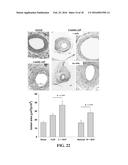 COMPOSITIONS AND METHODS FOR TREATMENT OF VESSEL DISEASE diagram and image