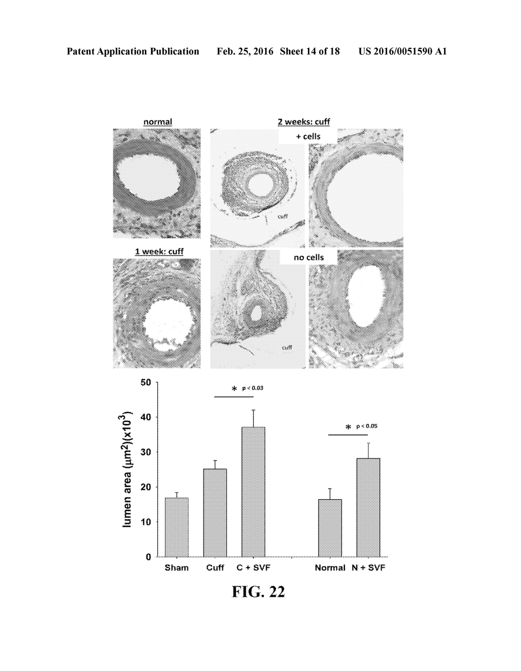 COMPOSITIONS AND METHODS FOR TREATMENT OF VESSEL DISEASE - diagram, schematic, and image 15