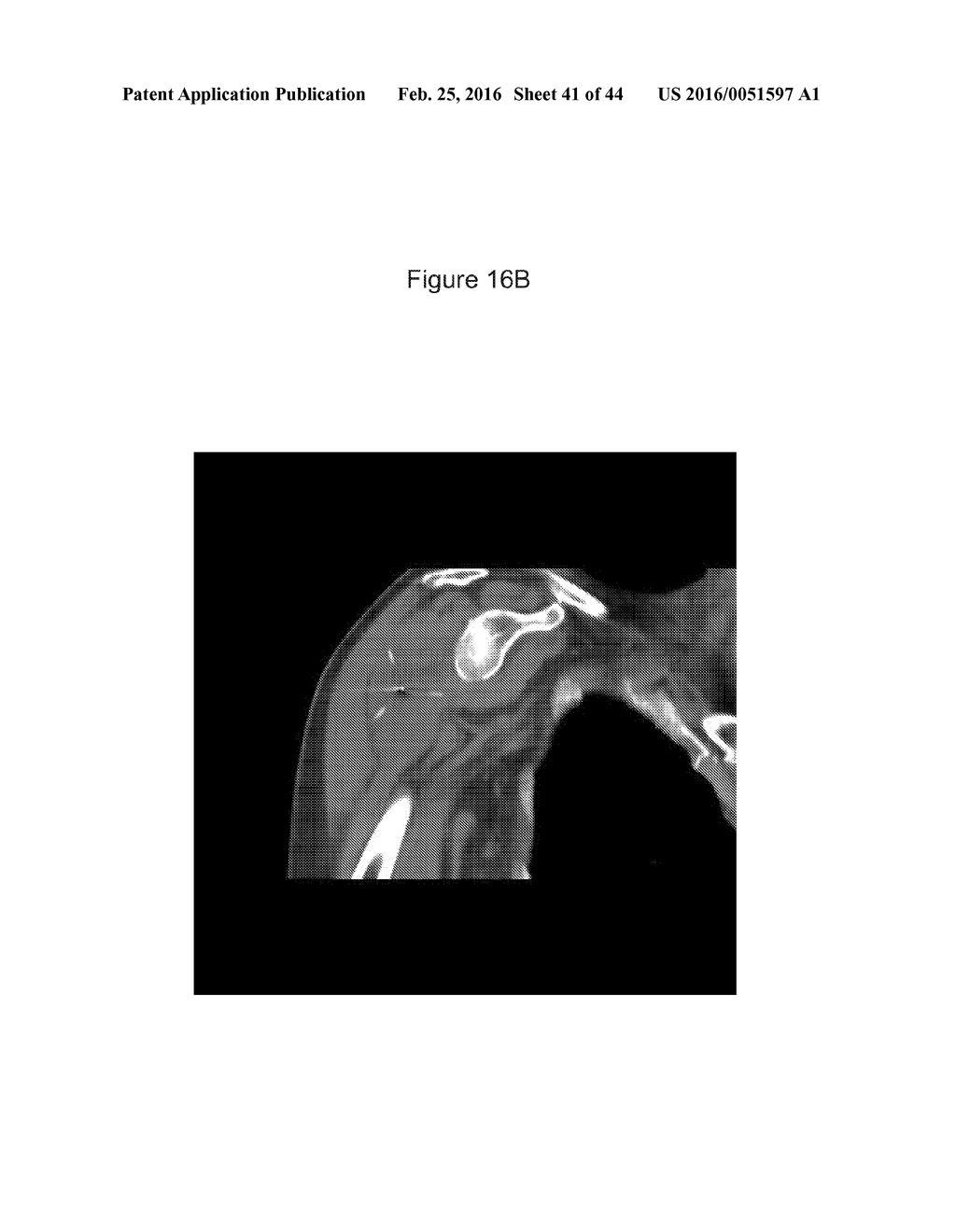 C. NOVYI FOR THE TREATMENT OF SOLID TUMORS IN HUMANS - diagram, schematic, and image 42