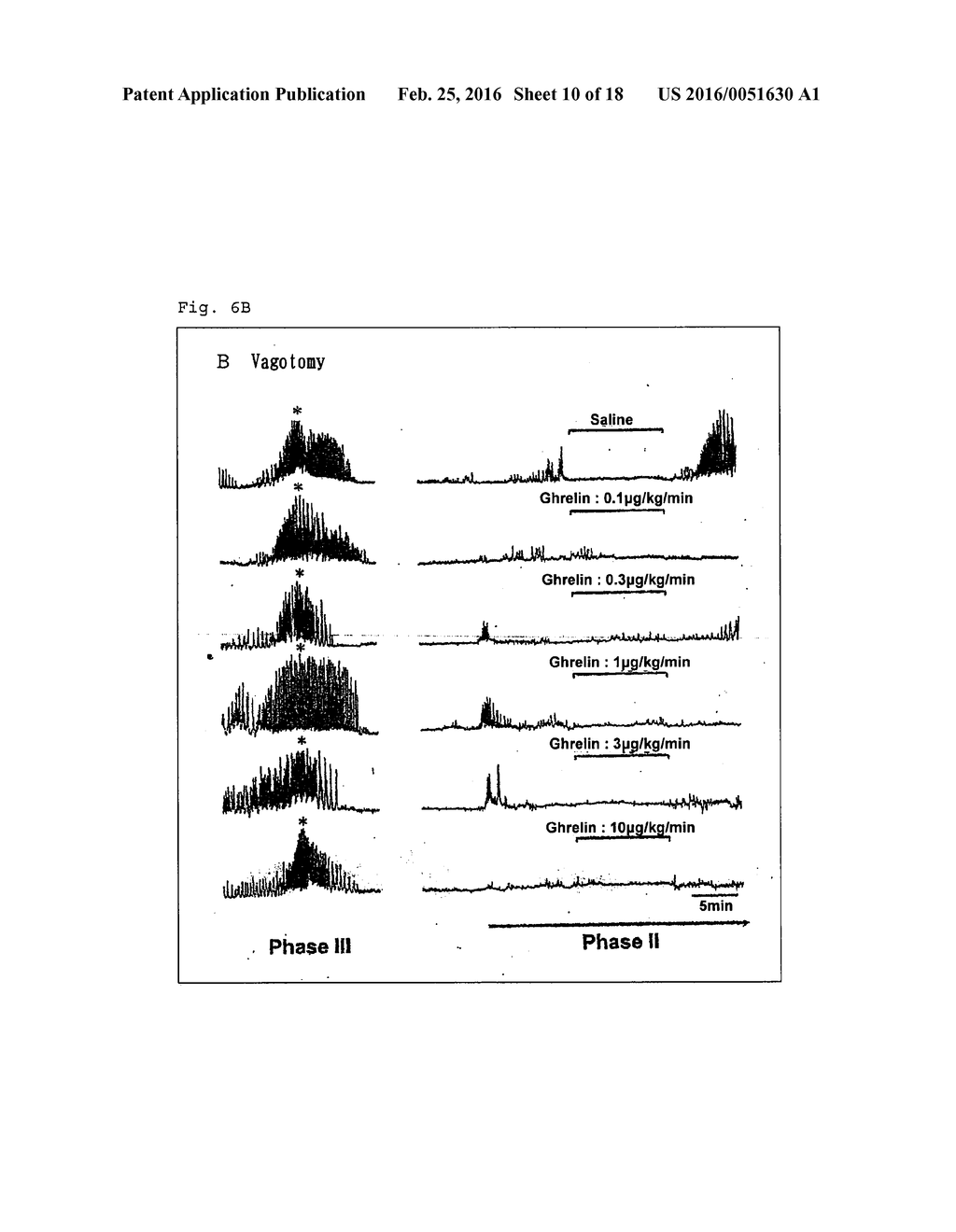 POSTPRANDIAL GASTROKINETIC AGENT - diagram, schematic, and image 11