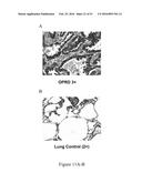 MOLECULAR IMAGING PROBES FOR LUNG CANCER INTRAOPERATIVE GUIDANCE diagram and image