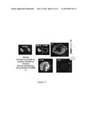 MOLECULAR IMAGING PROBES FOR LUNG CANCER INTRAOPERATIVE GUIDANCE diagram and image