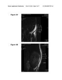 Reparative Cell Isolation and Delviery diagram and image