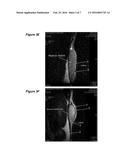 Reparative Cell Isolation and Delviery diagram and image