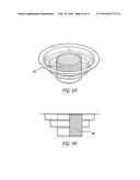 SHAPEABLE BONE GRAFT SUBSTITUTE AND INSTRUMENTS FOR DELIVERY THEREOF diagram and image