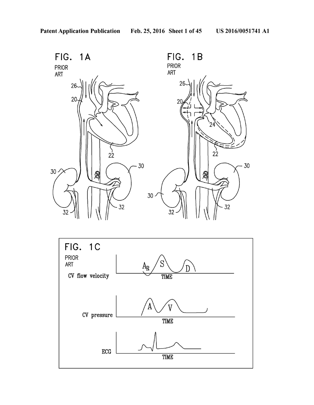 RENAL PUMP - diagram, schematic, and image 02