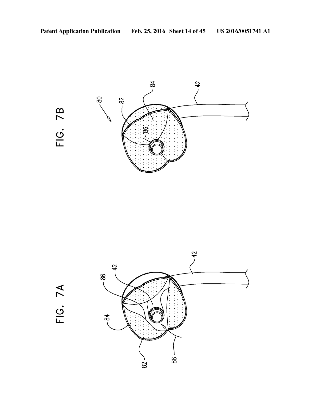 RENAL PUMP - diagram, schematic, and image 15