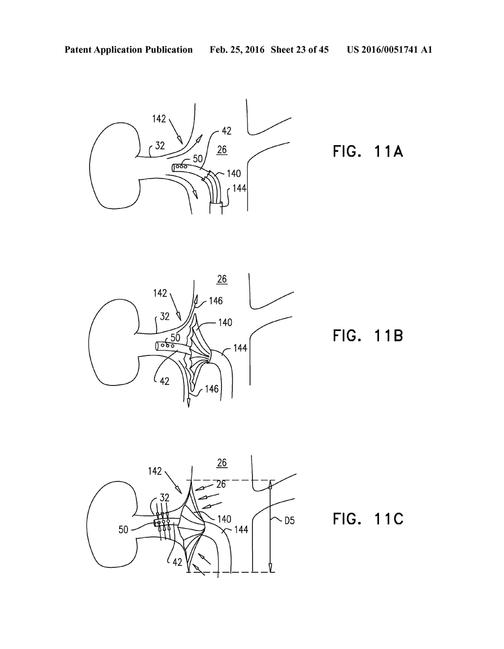 RENAL PUMP - diagram, schematic, and image 24