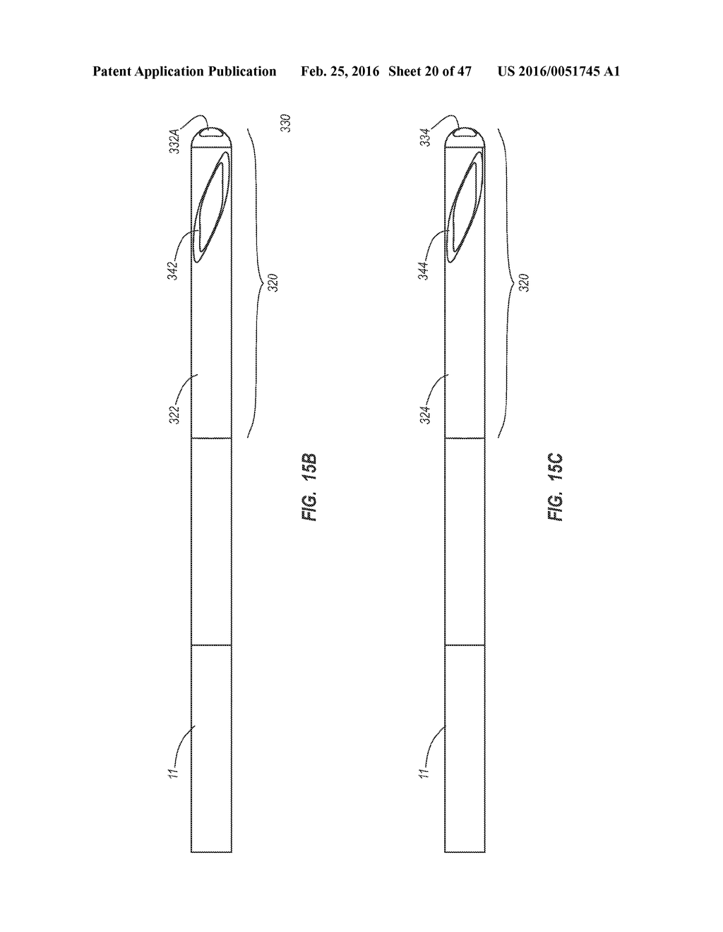 Solid-Body Catheter Including Lateral Distal Openings - diagram, schematic, and image 21