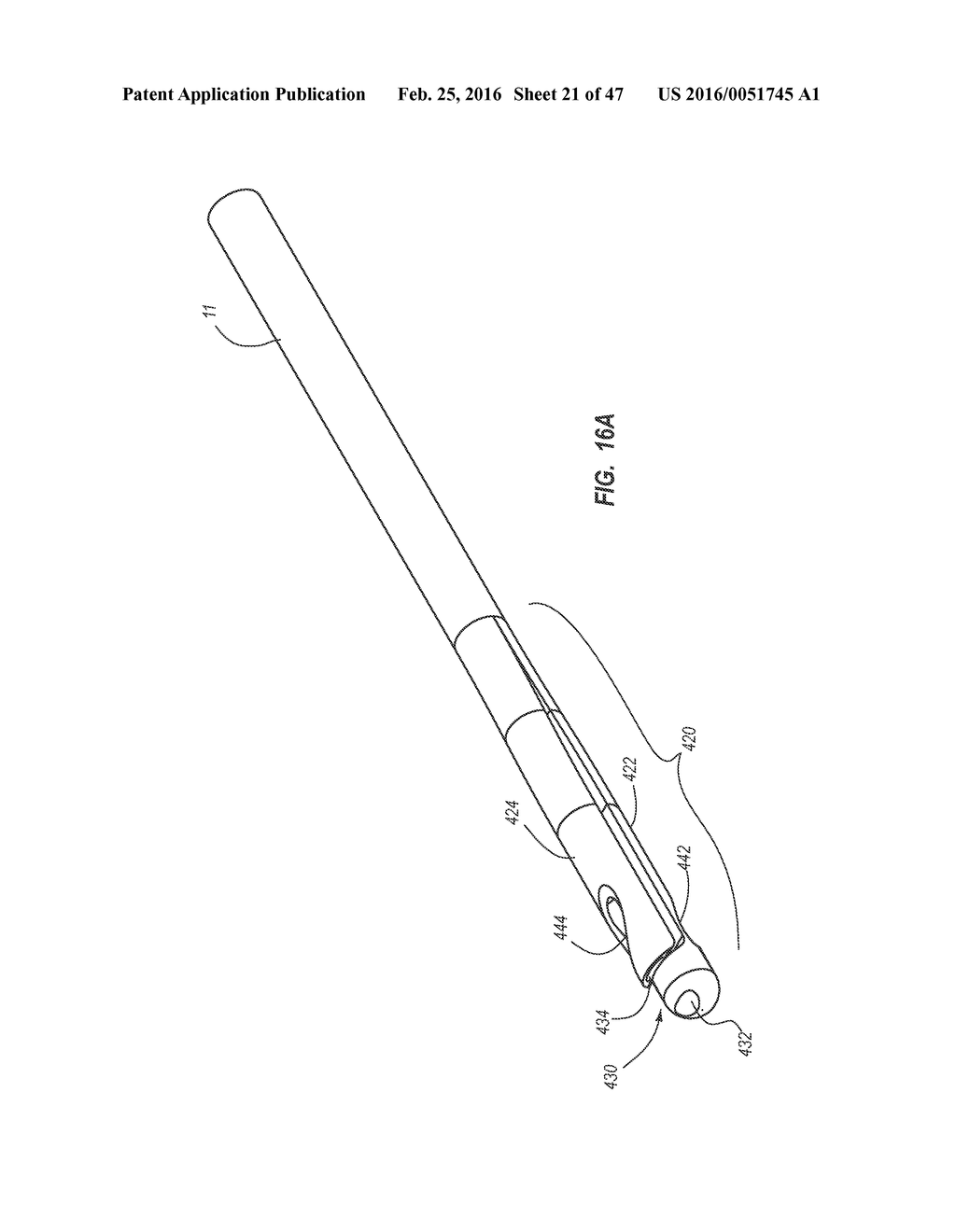 Solid-Body Catheter Including Lateral Distal Openings - diagram, schematic, and image 22