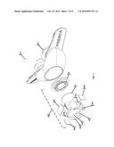 Apparatus, Systems, and Methods For Treating Obstructive Sleep Apnea diagram and image