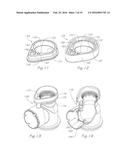 RESPIRATORY VALVE APPARATUS diagram and image