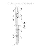 STABILIZING AND SEALING CATHETER FOR USE WITH A GUIDING CATHETER diagram and image