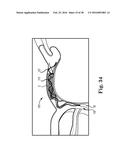 Devices and Systems for Access and Navigation of Cerebrospinal Fluid Space diagram and image