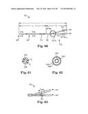 Devices and Systems for Access and Navigation of Cerebrospinal Fluid Space diagram and image