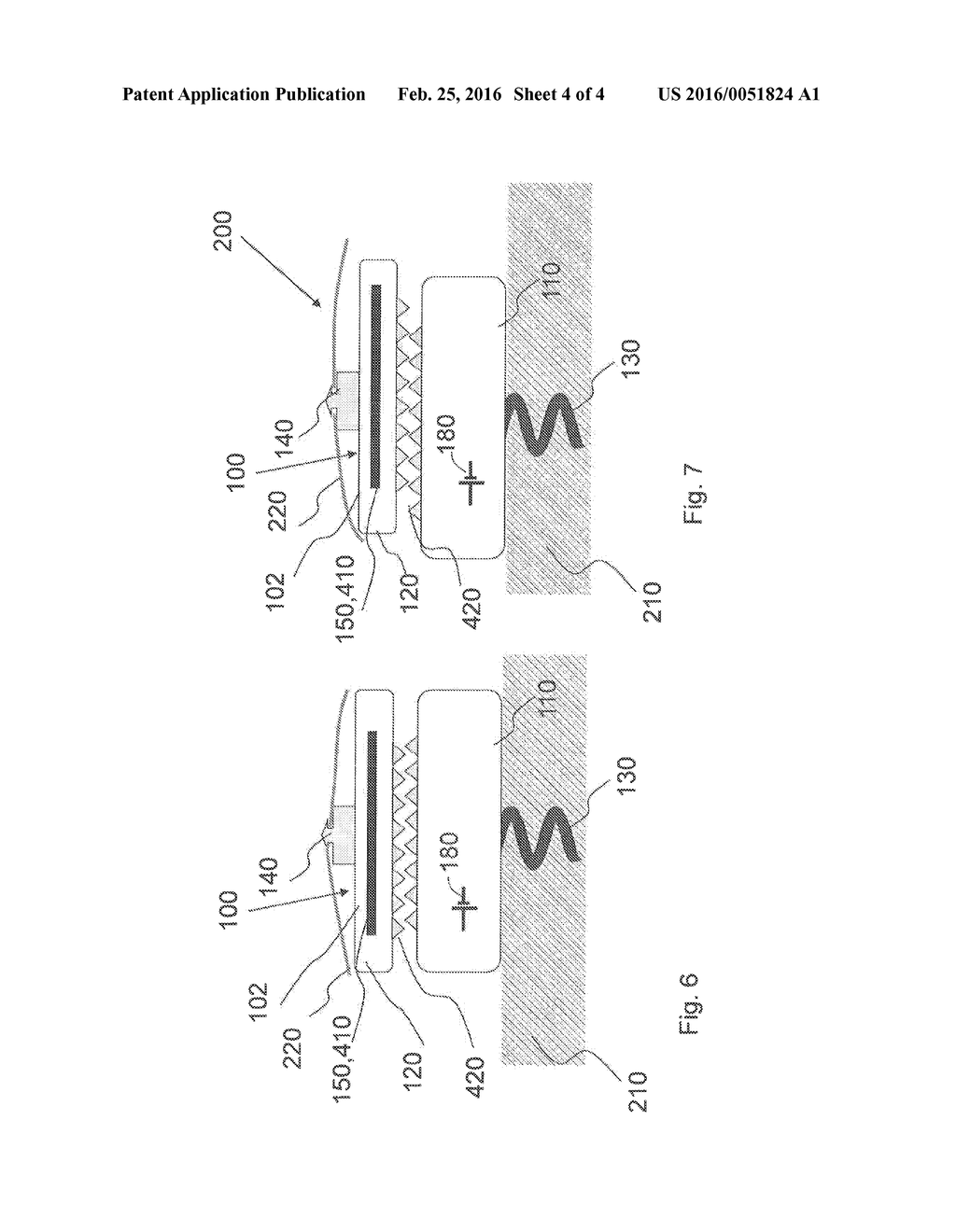 MEDICAL IMPLANT - diagram, schematic, and image 05