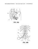 SYSTEM AND METHOD FOR OPTOGENETIC THERAPY diagram and image