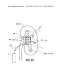 SYSTEM AND METHOD FOR OPTOGENETIC THERAPY diagram and image