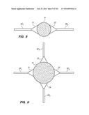 SYSTEM AND METHOD FOR OPTOGENETIC THERAPY diagram and image