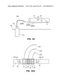 SYSTEM AND METHOD FOR OPTOGENETIC THERAPY diagram and image