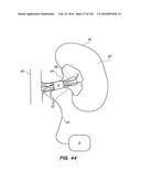 SYSTEM AND METHOD FOR OPTOGENETIC THERAPY diagram and image