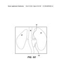 SYSTEM AND METHOD FOR OPTOGENETIC THERAPY diagram and image