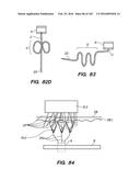 SYSTEM AND METHOD FOR OPTOGENETIC THERAPY diagram and image