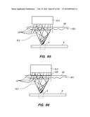 SYSTEM AND METHOD FOR OPTOGENETIC THERAPY diagram and image