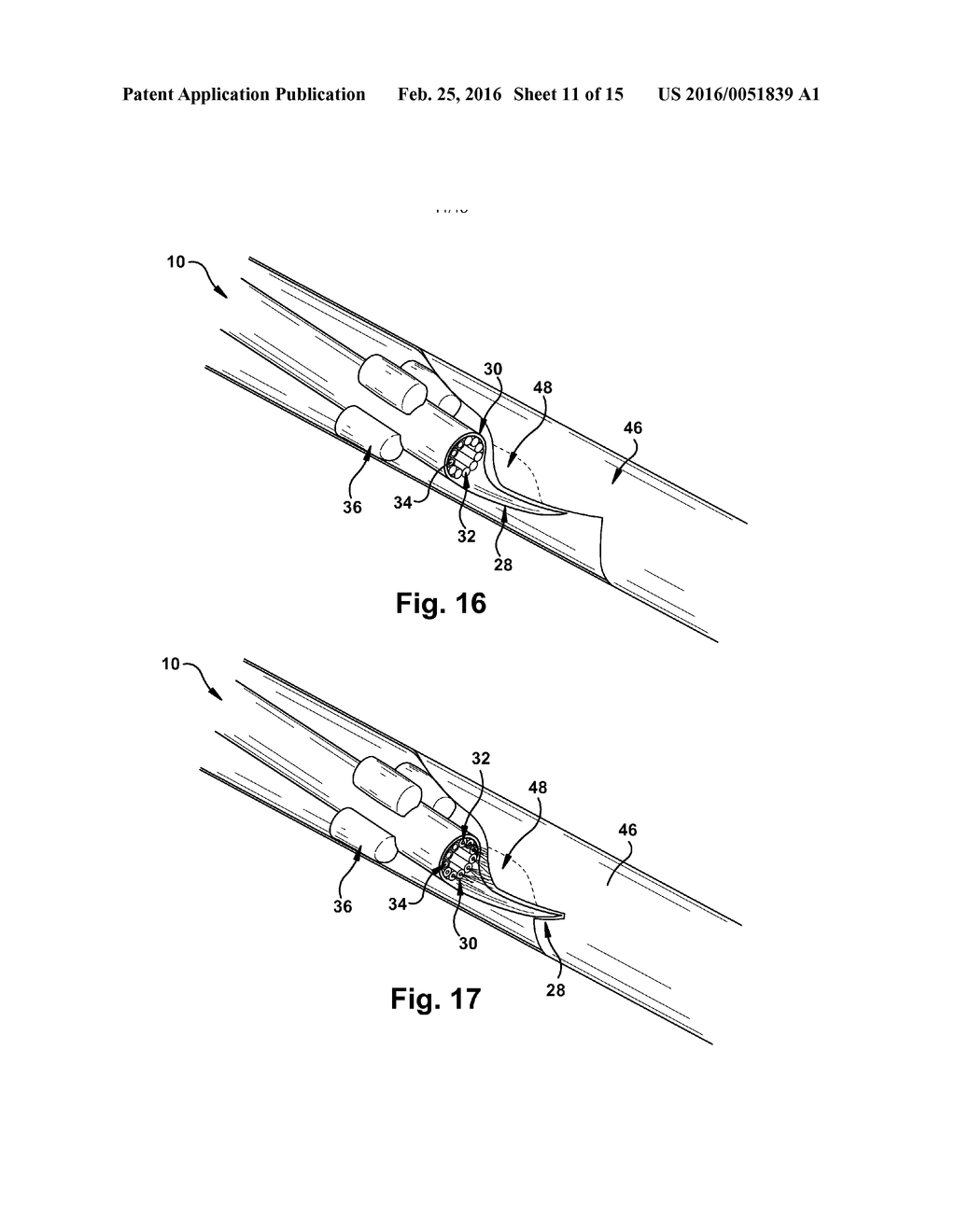 MULTITUBE ESOPHAGEAL BRACHYTHERAPY CATHETER - diagram, schematic, and image 12