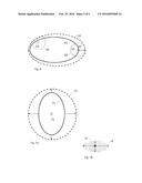 METHOD AND SYSTEM FOR ROBUST RADIOTHERAPY TREATMENT PLANNING diagram and image