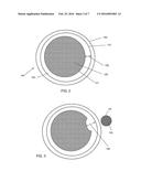 Image-Guided Radiotherapy For Internal Tumor Boost diagram and image