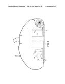 POOL CLEANER WITH FILTER WITH SELF CLEANING MEANS AND HIGH INTERNAL     PRESSURE diagram and image