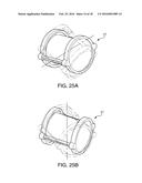 APPARATUS FOR MECHANICAL EXFOLIATION OF PARICULATE MATERIALS diagram and image