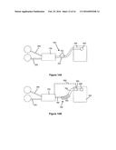 SERIES ENABLED MULTI-MATERIAL EXTRUSION TECHNOLOGY diagram and image