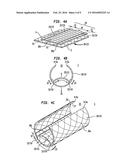 Rigid Slit-Tube Laminate System diagram and image