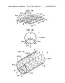 Rigid Slit-Tube Laminate System diagram and image